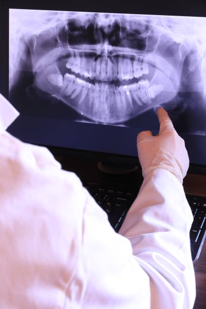 Best Broken or Cracked Tooth Emergency Dentist in Rosharon, TX