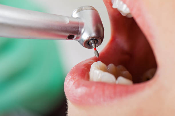 Best Mobile Emergency Dentist in Rosharon, TX